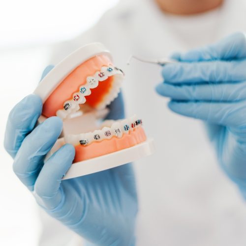 Dentist's,Work,In,Dental,Office,,Showing,Jaw,With,Braces.,Orthodontic